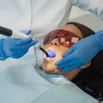 Cosmetic Dental Procedures We Should Consider Having